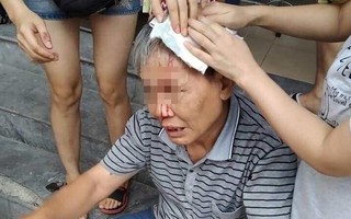 Hà Nội: Đưa cháu xuống chơi ở sân chung cư, người ông bị ổ khóa rơi trúng đầu gây thương tích