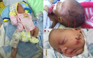 Những trẻ chào đời bị rách mặt, gãy chân tay do lỗi bác sĩ khiến các mẹ bầu hết hồn, nhiều trường hợp bác sĩ giải thích khó nghe