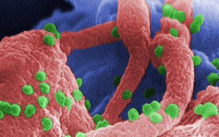 Lần đầu tiên các nhà khoa học loại bỏ được HIV trong toàn bộ gen của chuột: Đem lại hi vọng loại bỏ HIV ở người