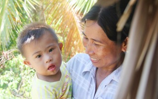 Ánh mắt ngây dại của bé trai 3 tuổi, mắc hội chứng down bên người mẹ khờ: Phép màu đã xuất hiện