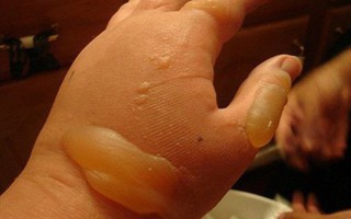 7 sai lầm trong trị bệnh gây hậu quả nặng nề cho trẻ mà cha mẹ hay mắc
