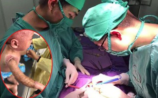Bé trai 2 tuổi bị bỏng nước sôi nghiêm trọng, bác sĩ cảnh báo mức độ bỏng nguy hiểm đến tính mạng trẻ