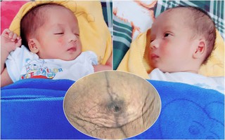 Mẹ sinh đôi đăng ảnh vòng 2 sau sinh, các mẹ lại rần rần cảm thán "Thương thay thân phận đàn bà!"
