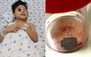 Bé trai 5 tuổi giãy giụa nguy kịch vì nuốt phải món đồ chơi bố mẹ nào cũng mua cho con 
