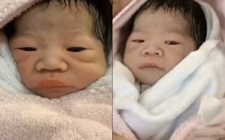 Sinh ra xấu xí bị nhiều người quở, bé gái sau vài tháng lớn lên ngoại hình “lột xác” khiến dân mạng ngỡ ngàng