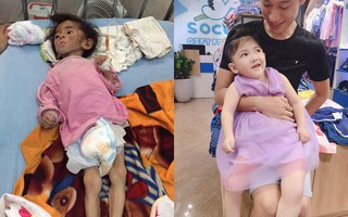 Bất ngờ với "cơ thể mới" của cô bé gầy trơ xương Thào Thị Yến Nhi ngày nào, sau khi được mẹ nuôi nhận về chăm sóc suốt 3 năm