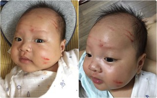 Tâm sự đẻ dày: Ra ngoài 30 giây, mẹ tá hỏa khi quay lại thấy em bị chị cào khắp mặt