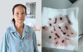 Một phụ nữ đang xem tivi bất chợt đột quỵ nhưng may mắn được cứu sống nhờ trí tuệ nhân tạo dù đã quá "giờ vàng"
