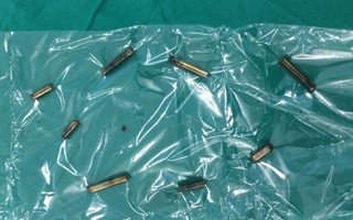 Bé trai 4 tuổi thủng ruột vì nuốt thứ quá đỗi quen thuộc nhà nào cũng dùng