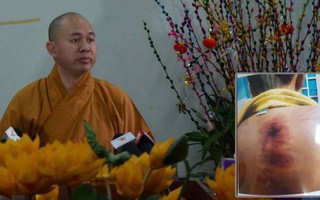 Vụ bé trai nghi bị xâm hại, đánh đập khi tham gia khóa tu mùa hè: GHPG công bố ông Thiện Lam không phải nhà tu hành