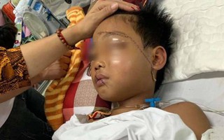 Thông tin mới nhất vụ chú họ chém cháu đứt lìa bàn tay ở Bắc Giang