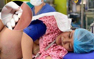 Bác sĩ sản khoa nói về mũi tiêm "đẻ không đau", hóa ra trước giờ các mẹ toàn hiểu lầm