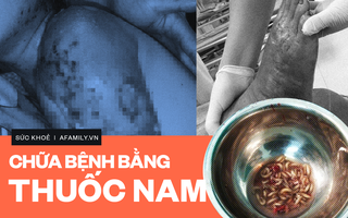 Vô vàn những kiểu chữa bệnh bằng thuốc nam tai hại khiến bệnh đã nặng càng nặng thêm