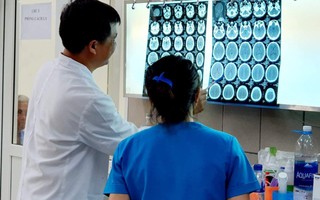 Ca đầu tiên ở Việt Nam ghi nhận ma túy đá gây ra xuất huyết não ở người trẻ tuổi