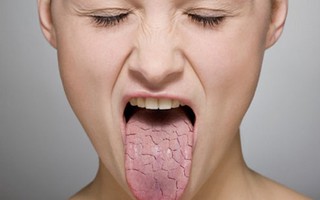 Gặp vấn đề về vị giác có thể là tín hiệu cảnh báo bạn đang gặp những tình trạng sức khỏe nghiêm trọng như thế này