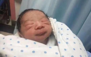Sinh ra gương mặt nhăn nhúm như quả bí ngô, đến mẹ đẻ cũng gọi là "người ngoài hành tinh", em bé bỗng lột xác ngỡ ngàng chỉ sau nửa năm