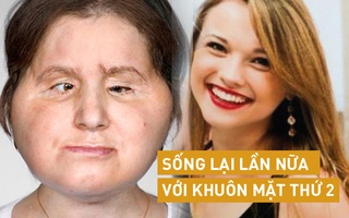 Hành trình của người phụ nữ trẻ nhất thế giới được cấy ghép khuôn mặt từ người hiến tặng và cuộc chiến với tử thần kéo dài 31 tiếng