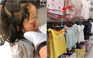 Bé gái bị mù tạm thời một bên mắt vì thứ siêu thị nào cũng có, cha mẹ đưa con đi mua sắm ngày Tết cần lưu ý