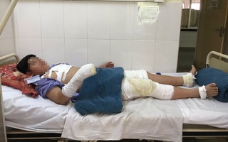 Bệnh nhi bị bỏng cồn nặng: Chuyên gia cảnh báo bố mẹ cần cảnh giác cao độ với tai nạn con dễ gặp khi nghỉ Tết dài