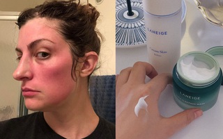 Phần lớn chị em đều mắc một sai lầm khi mua đồ skincare khiến da “toang” như chơi, và đây chính là bằng chứng hùng hồn