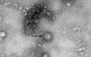Xác nhận bệnh nhân Thái Lan đầu tiên bị nhiễm chủng virus corona mới