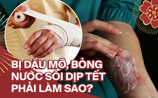 Vào bếp ngày Tết hãy trang bị kỹ năng sơ cứu đúng nếu chẳng may bị bỏng