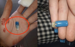 Mới đầu năm đã “toang” cả móng thật lẫn móng giả, chuyên gia lưu ý tới các chị em có thú vui làm nails 