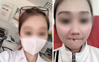 Cắn hướng dương ngày Tết, cô gái trẻ bị... rụng cả răng cửa tốn thêm bạc triệu để làm mới