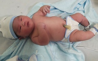 Vô cùng hiếm gặp ở Việt Nam: Bé trai chào đời có cân nặng lên đến 6,5kg