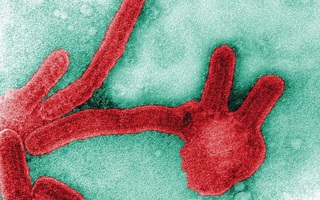 Những loại virus gây chết người kinh khủng nhất mọi thời đại