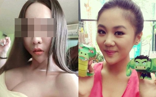Phát choáng với những chiếc cằm dao kéo nhọn hoắt như... mũi kim