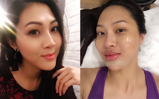 Hoa khôi Diệu Ngọc vướng nghi án thẩm mỹ trước thềm chung kết HHTG 2016