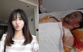 Nữ cử nhân xinh đẹp bị bỏng toàn thân sau khi gặp tai nạn đã trút hơi thở cuối cùng