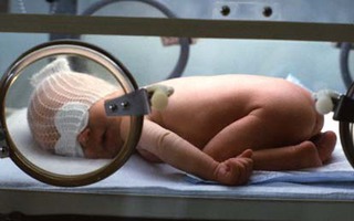 Những điều cha mẹ cần chú ý khi chăm sóc trẻ sinh non