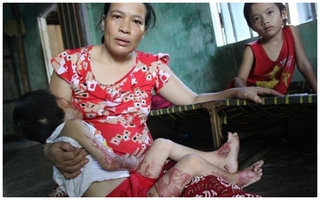 Em bé ở Quảng Nam: Mẹ ơi! khi mô lột mặt nạ ra để con được đến trường với các bạn?