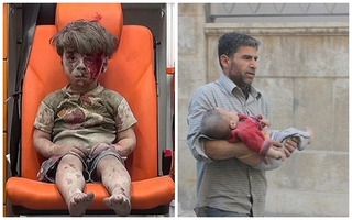 Thêm hình ảnh em bé Syria bị thương sau khi trận không kích khiến thế giới xót xa