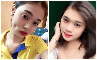 Cô gái trẻ xinh đẹp tố cơ sở thẩm mỹ giá rẻ làm má lúm đồng tiền hỏng khiến mặt bị biến dạng