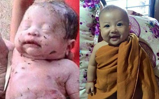 Bé trai sơ sinh bị đâm 14 nhát dao rồi chôn sống ở Thái Lan giờ ra sao? 