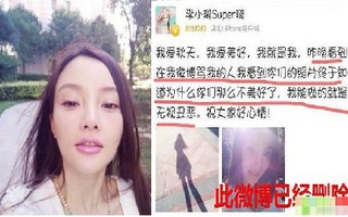Cư dân mạng chỉ trích Lý Tiểu Lộ phủ nhận chuyện "dao kéo"