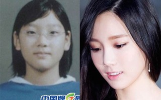 SNSD - Xinh đẹp hoàn hảo nhưng ai cũng vướng nghi án phẫu thuật thẩm mỹ