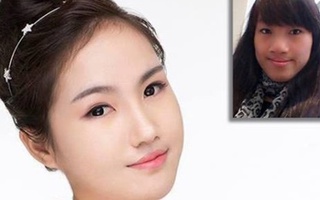 Ngỡ ngàng 9x Thái Nguyên mặt thô kệch trở nên thon gọn, xinh đẹp