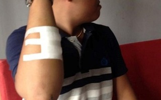 Hiệp sĩ được Bộ trưởng chỉ đạo điều trị miễn phí bị sốc thuốc