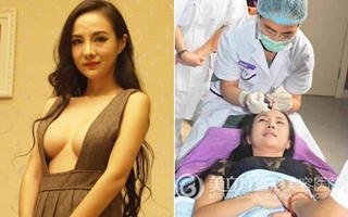 Lộ ảnh "đệ nhất mẫu nude" bí mật đi "trùng tu" nhan sắc