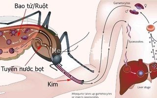 Hà Nội gia tăng  nhiều trường hợp mắc sốt xuất huyết