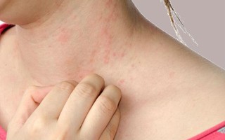 Cảnh báo 8 dấu hiệu ở da là triệu chứng của những bệnh cực nguy hiểm