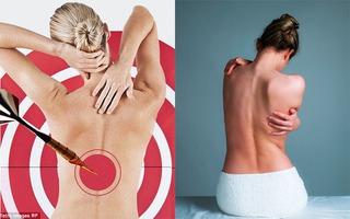 Chuyên gia về cột sống chỉ ra một số biện pháp chữa đau lưng chỉ càng làm bệnh nặng thêm