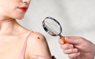 Vì sao một số bệnh nhân ung thư tự khỏi mà không cần điều trị?