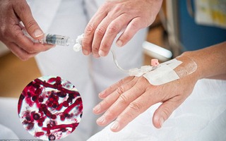 Cảnh báo chủng nhiễm trùng nấm men mới kháng thuốc và gây chết người đang "càn quét" toàn cầu