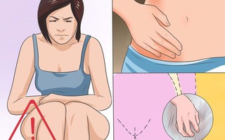 6 nguyên nhân và 9 triệu chứng thường gặp ở những người bị nhiễm trùng nấm Candida