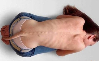 Cô gái mọc đuôi... dài 30cm